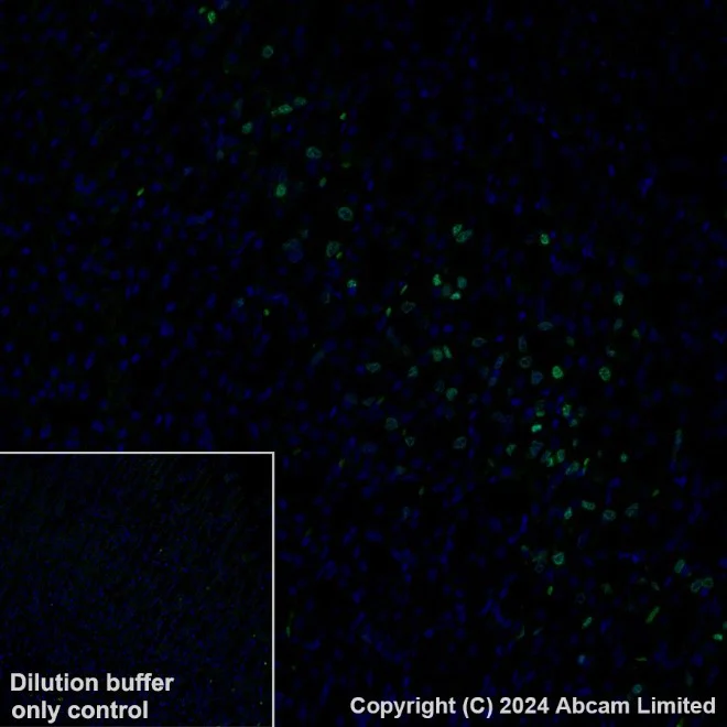 Immunohistochemistry (Formalin/PFA-fixed paraffin-embedded sections) - Anti-Ki67 antibody [B56] (AB279653)