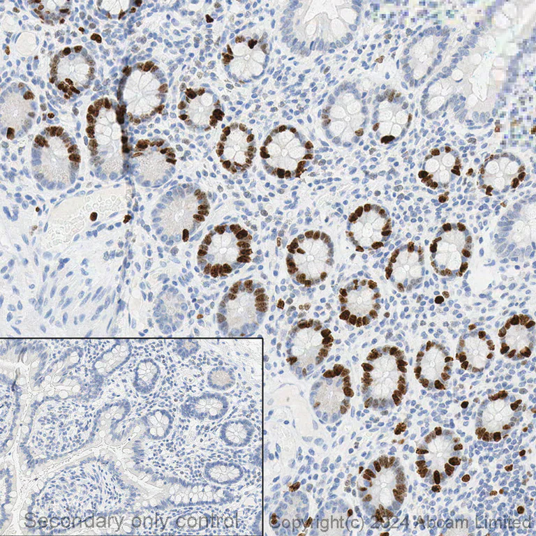Immunohistochemistry (Formalin/PFA-fixed paraffin-embedded sections) - Anti-Ki67 antibody [B56] (AB279653)