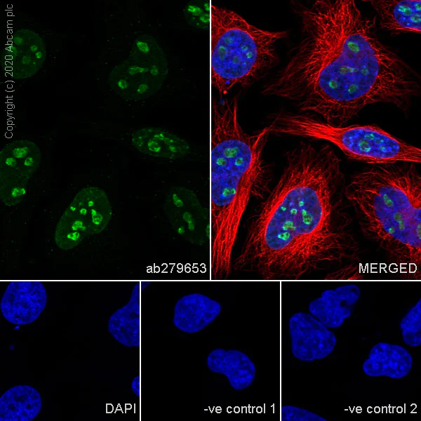 Anti-Ki67 antibody [B56] - Carrier free (ab279657) | Abcam