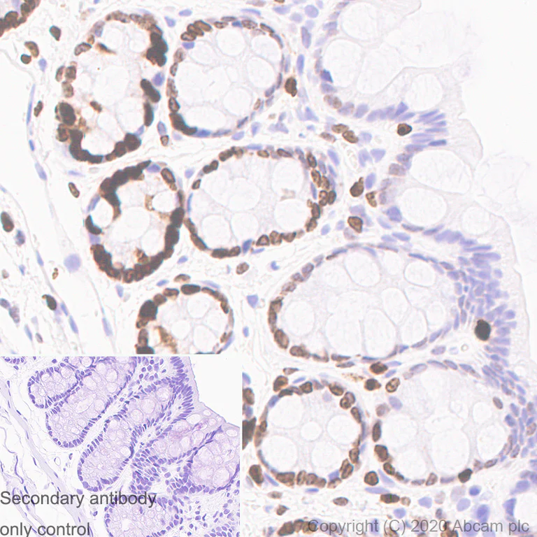 Immunohistochemistry (Formalin/PFA-fixed paraffin-embedded sections) - Anti-Ki67 antibody [B56] - BSA and Azide free (AB279657)