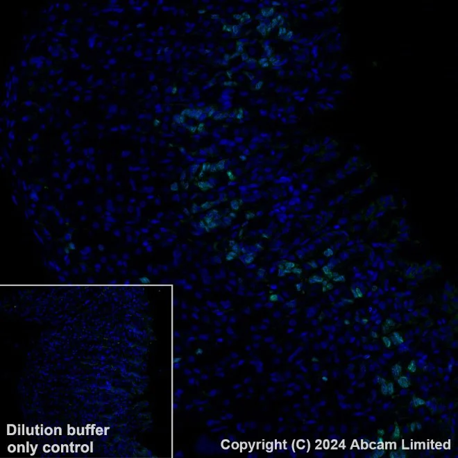 Immunohistochemistry (Formalin/PFA-fixed paraffin-embedded sections) - Anti-Ki67 antibody [B56] - BSA and Azide free (AB279657)