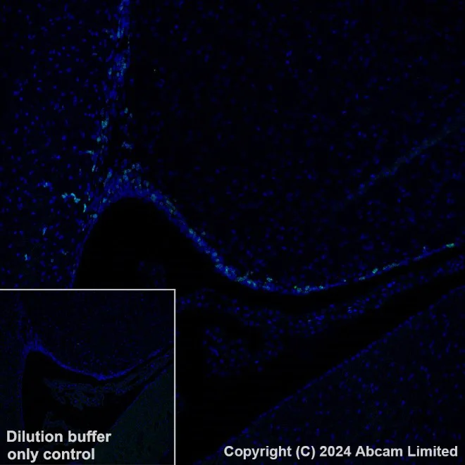 Anti-Ki67 antibody [B56] - Carrier free (ab279657) | Abcam