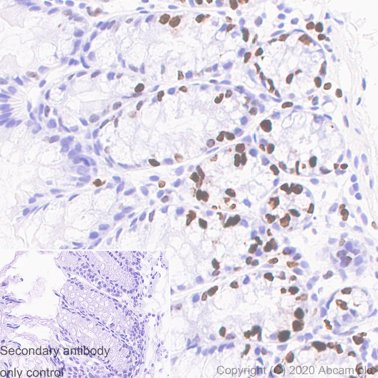 Immunohistochemistry (Formalin/PFA-fixed paraffin-embedded sections) - Anti-Ki67 antibody [B56] - BSA and Azide free (AB279657)
