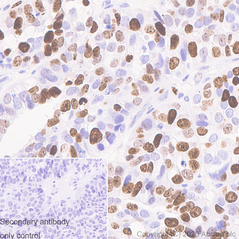 Immunohistochemistry (Formalin/PFA-fixed paraffin-embedded sections) - Anti-Ki67 antibody [B56] - BSA and Azide free (AB279657)