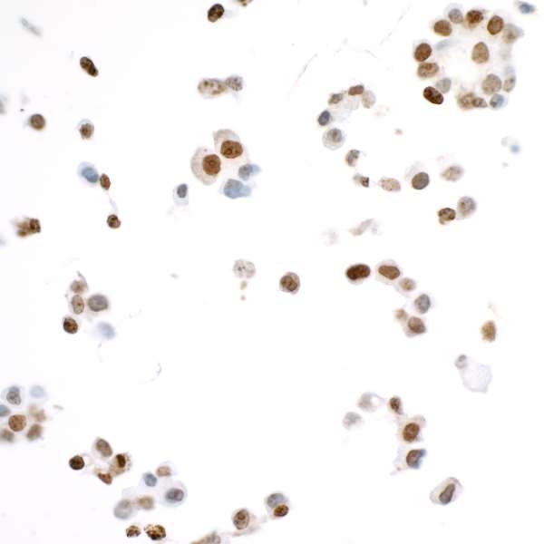 Immunocytochemistry - Anti-Ki67 antibody [BLR021E] (AB243878), expandable thumbnail