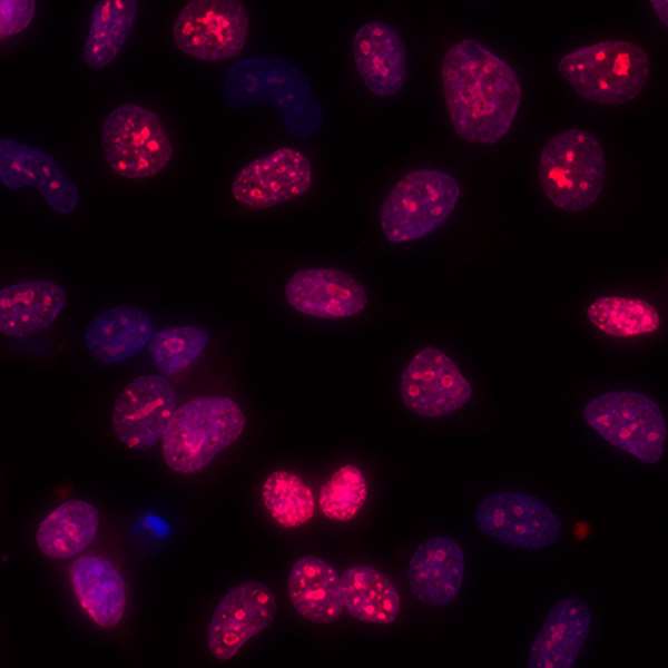 Immunocytochemistry/ Immunofluorescence - Anti-Ki67 antibody [BLR021E] (AB243878), expandable thumbnail
