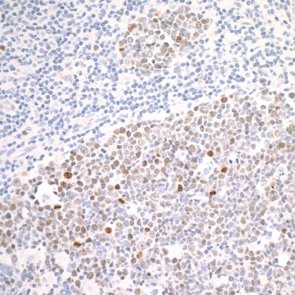 Immunohistochemistry (Formalin/PFA-fixed paraffin-embedded sections) - Anti-Ki67 antibody [BLR021E] (AB243878)