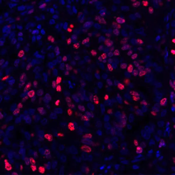 Immunohistochemistry (Formalin/PFA-fixed paraffin-embedded sections) - Anti-Ki67 antibody [BLR021E] (AB243878)