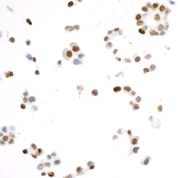 Immunocytochemistry - Anti-Ki67 antibody [BLR021E] - BSA free (AB272075)