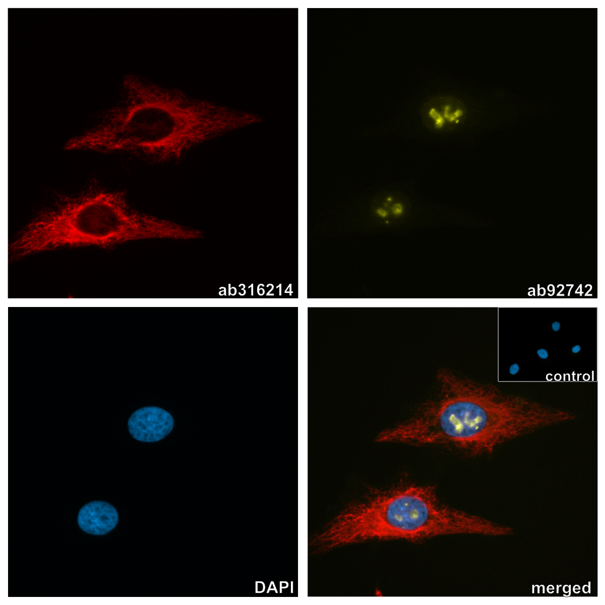 タ荷D0429◆H148cm×W88cm◆アンティーク◆レトロな洋館の大きい木製ガラスケース◆飾り棚 収納棚 食器棚 キャビネット 映画撮影P(ヤD)松