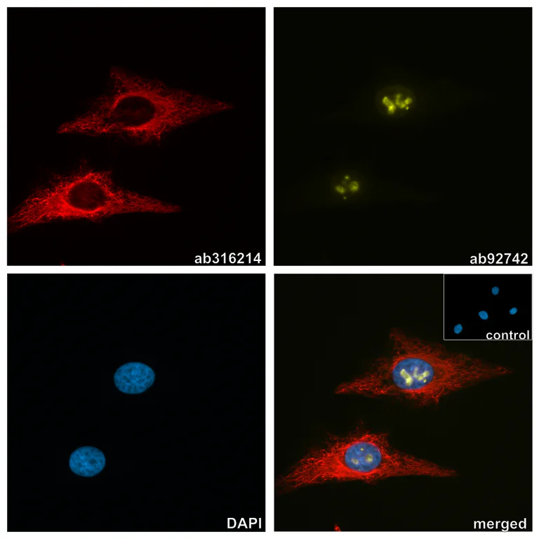 Immunocytochemistry/ Immunofluorescence - Anti-Ki67 antibody [EPR3610] (AB92742)