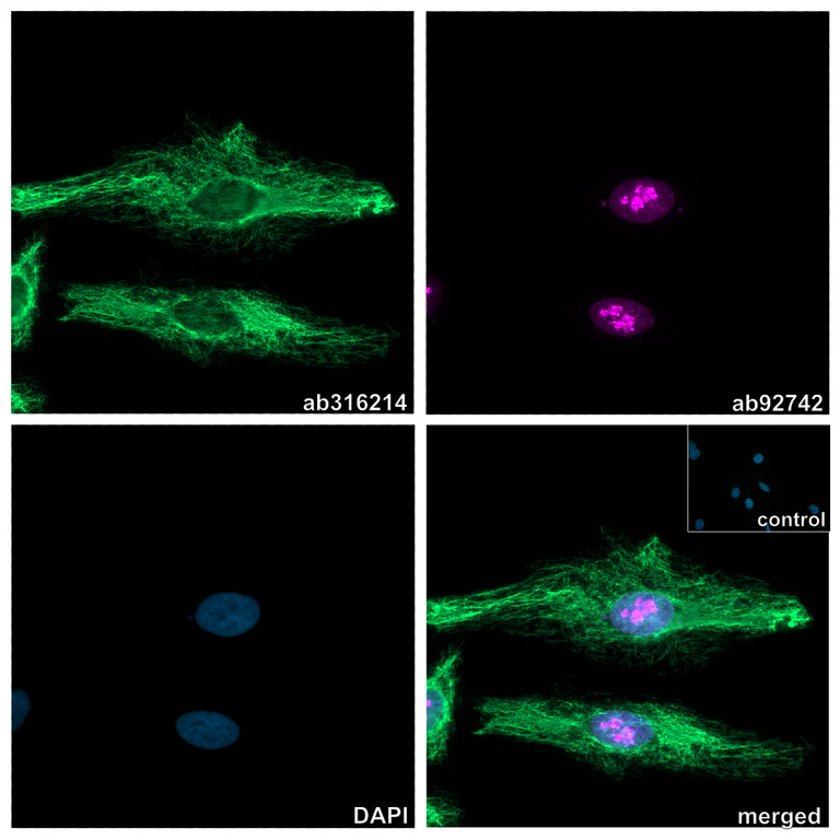 Immunocytochemistry/ Immunofluorescence - Anti-Ki67 antibody [EPR3610] (AB92742)