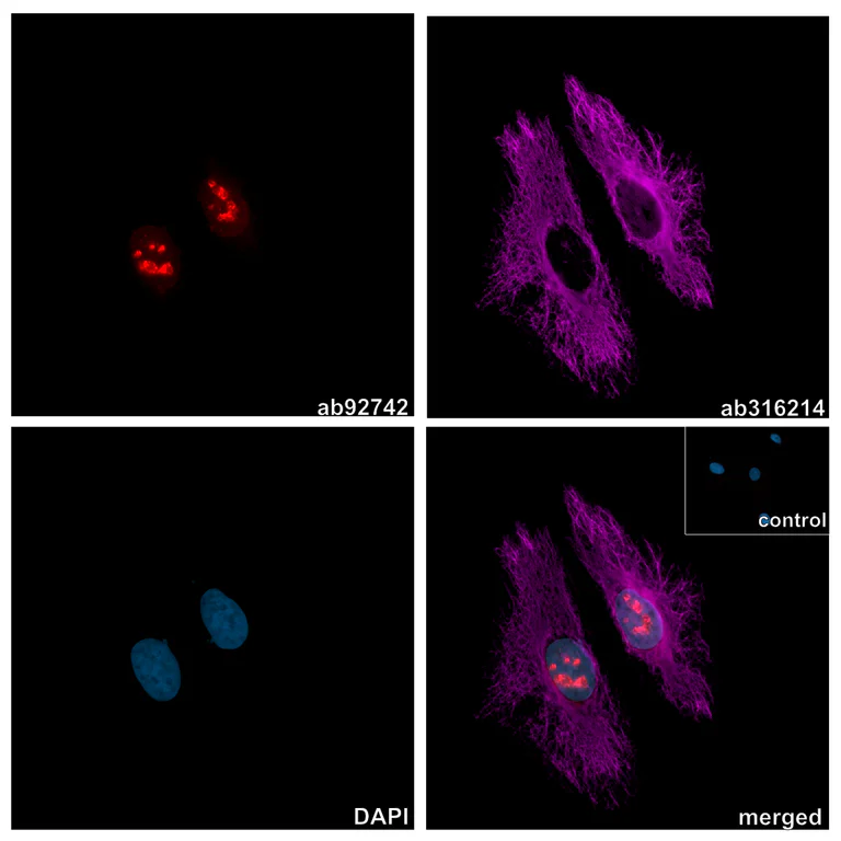 Immunocytochemistry/ Immunofluorescence - Anti-Ki67 antibody [EPR3610] (AB92742)