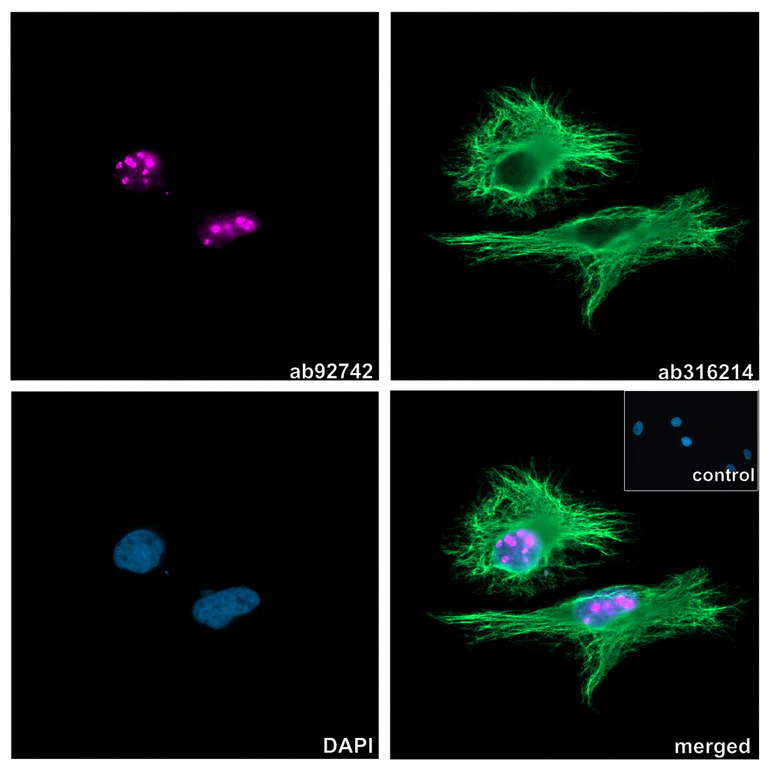 Immunocytochemistry/ Immunofluorescence - Anti-Ki67 antibody [EPR3610] (AB92742)