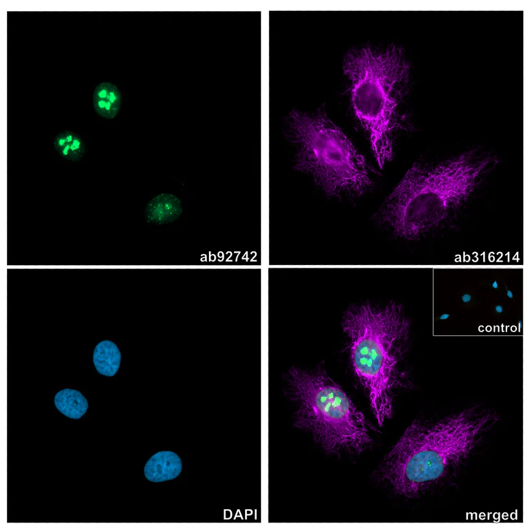 Immunocytochemistry/ Immunofluorescence - Anti-Ki67 antibody [EPR3610] (AB92742)