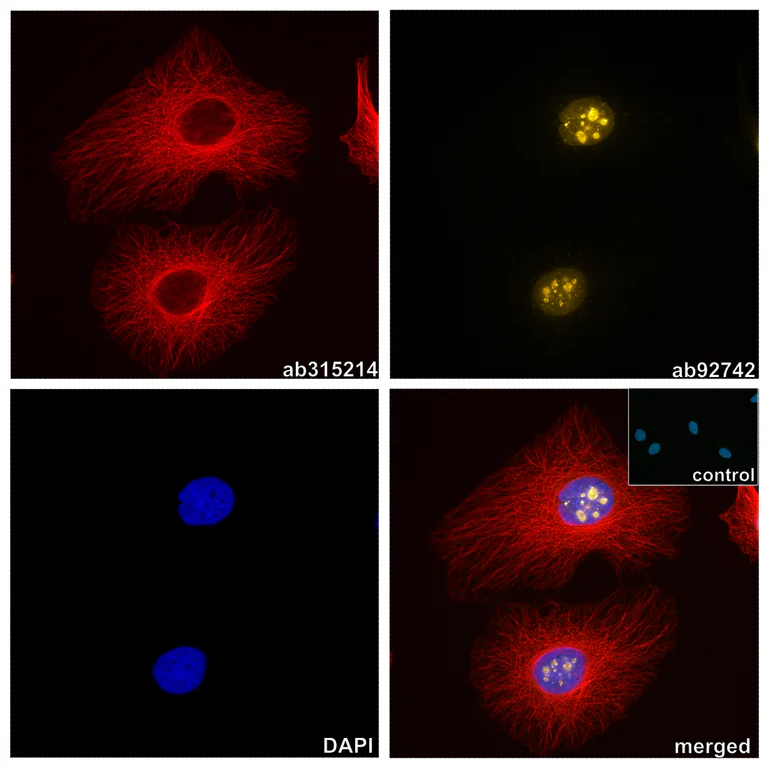 Immunocytochemistry/ Immunofluorescence - Anti-Ki67 antibody [EPR3610] (AB92742)