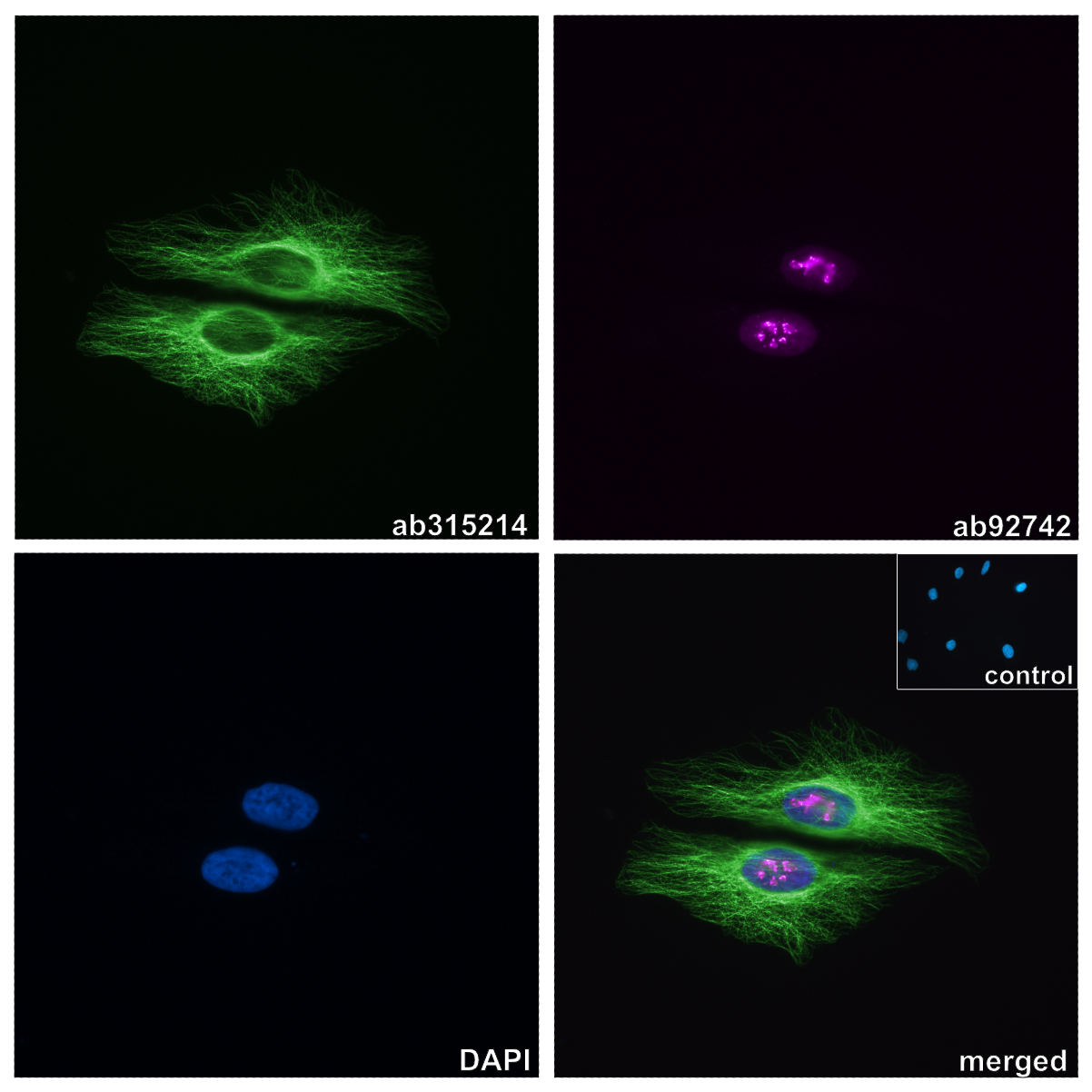 Anti-Ki67 抗体 [EPR3610] (ab92742) | Abcam