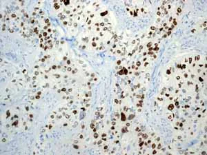 Immunohistochemistry (Formalin/PFA-fixed paraffin-embedded sections) - Anti-Ki67 antibody [EPR3610] (AB92742)