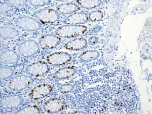 Immunohistochemistry (Formalin/PFA-fixed paraffin-embedded sections) - Anti-Ki67 antibody [EPR3610] (AB92742)