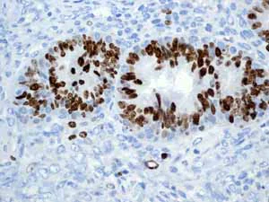 Immunohistochemistry (Formalin/PFA-fixed paraffin-embedded sections) - Anti-Ki67 antibody [EPR3610] (AB92742)