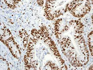 Immunohistochemistry (Formalin/PFA-fixed paraffin-embedded sections) - Anti-Ki67 antibody [EPR3610] (AB92742)