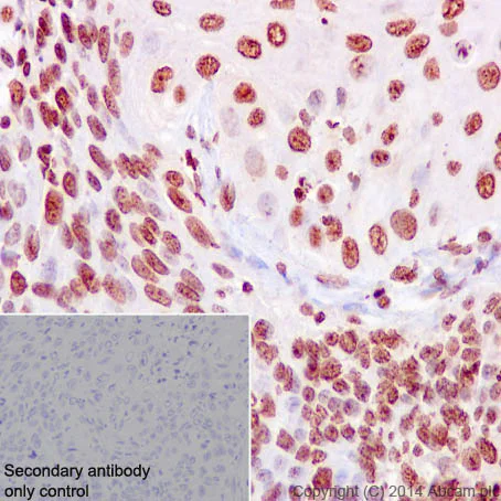 Immunohistochemistry (Formalin/PFA-fixed paraffin-embedded sections) - Anti-Ki67 antibody [EPR3610] (AB92742)