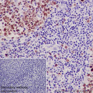 Immunohistochemistry (Formalin/PFA-fixed paraffin-embedded sections) - Anti-Ki67 antibody [EPR3610] - BSA and Azide free (AB209897)
