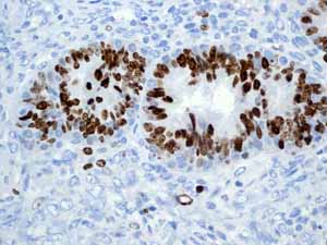 Immunohistochemistry (Formalin/PFA-fixed paraffin-embedded sections) - Anti-Ki67 antibody [EPR3610] - BSA and Azide free (ab209897), expandable thumbnail