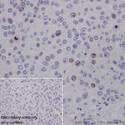 Immunohistochemistry (Formalin/PFA-fixed paraffin-embedded sections) - Anti-Ki67 antibody [EPR3610] - BSA and Azide free (AB209897)