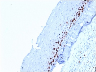 Immunohistochemistry (Formalin/PFA-fixed paraffin-embedded sections) - Anti-Ki67 antibody [MKI67/2462] - BSA and Azide free (AB237863), expandable thumbnail
