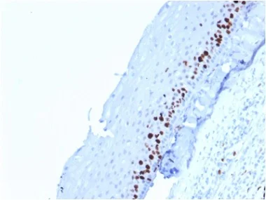 Immunohistochemistry (Formalin/PFA-fixed paraffin-embedded sections) - Anti-Ki67 antibody [MKI67/2462] - BSA and Azide free (AB237863)