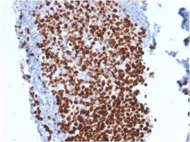 Immunohistochemistry (Formalin/PFA-fixed paraffin-embedded sections) - Anti-Ki67 antibody [MKI67/2462] - BSA and Azide free (AB237863), expandable thumbnail