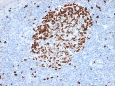 Immunohistochemistry (Formalin/PFA-fixed paraffin-embedded sections) - Anti-Ki67 antibody [MKI67/2462] - BSA and Azide free (AB237863)