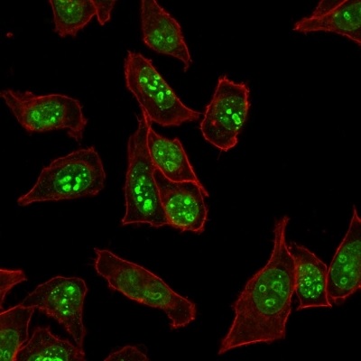Immunocytochemistry - Anti-Ki67 antibody [MKI67/2465] (AB238020), expandable thumbnail