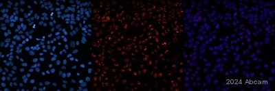 Immunocytochemistry - Anti-Ki67 antibody [MKI67/2465] (ab238020), expandable thumbnail