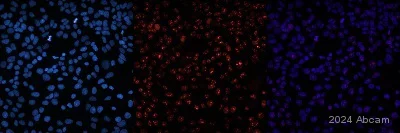 Immunocytochemistry - Anti-Ki67 antibody [MKI67/2465] (AB238020)