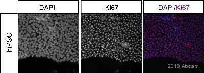 Immunocytochemistry - Anti-Ki67 antibody [MKI67/2465] (AB238020), expandable thumbnail