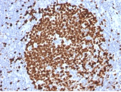 Immunohistochemistry (Formalin/PFA-fixed paraffin-embedded sections) - Anti-Ki67 antibody [MKI67/2465] (AB238020), expandable thumbnail