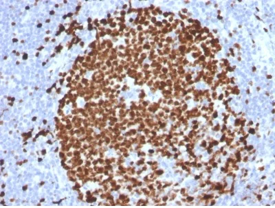 Anti-Ki67 antibody [MKI67/2465] (ab238020) | Abcam