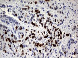 Immunohistochemistry (Formalin/PFA-fixed paraffin-embedded sections) - Anti-Ki67 antibody [OTI5D7] (AB156956), expandable thumbnail