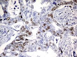 Immunohistochemistry (Formalin/PFA-fixed paraffin-embedded sections) - Anti-Ki67 antibody [OTI5D7] (AB156956)