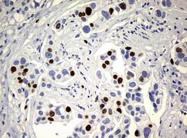 Immunohistochemistry (Formalin/PFA-fixed paraffin-embedded sections) - Anti-Ki67 antibody [OTI5D7] (ab156956), expandable thumbnail