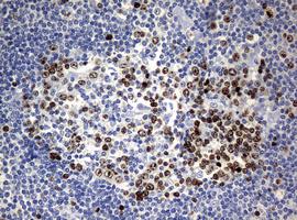 Immunohistochemistry (Formalin/PFA-fixed paraffin-embedded sections) - Anti-Ki67 antibody [OTI5D7] (AB156956), expandable thumbnail