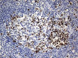 Immunohistochemistry (Formalin/PFA-fixed paraffin-embedded sections) - Anti-Ki67 antibody [OTI5D7] (AB156956)