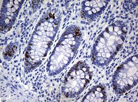 Immunohistochemistry (Formalin/PFA-fixed paraffin-embedded sections) - Anti-Ki67 antibody [OTI5D7] (AB156956), expandable thumbnail