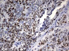 Immunohistochemistry (Formalin/PFA-fixed paraffin-embedded sections) - Anti-Ki67 antibody [OTI5D7] (AB156956)