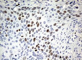 Immunohistochemistry (Formalin/PFA-fixed paraffin-embedded sections) - Anti-Ki67 antibody [OTI5D7] (ab156956), expandable thumbnail