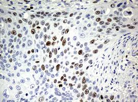 Immunohistochemistry (Formalin/PFA-fixed paraffin-embedded sections) - Anti-Ki67 antibody [OTI5D7] (AB156956)