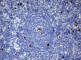 Immunohistochemistry (Formalin/PFA-fixed paraffin-embedded sections) - Anti-Ki67 antibody [OTI5D7] (ab156956), expandable thumbnail