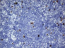 Immunohistochemistry (Formalin/PFA-fixed paraffin-embedded sections) - Anti-Ki67 antibody [OTI5D7] (AB156956)